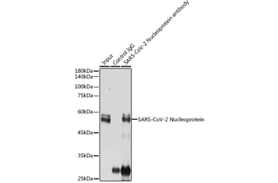 Western Blot - Anti-SARS-CoV2 Nucleoprotein Antibody (A307731) - Antibodies.com