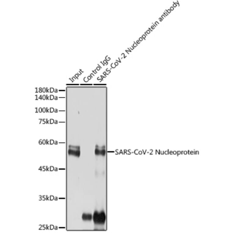 Western Blot - Anti-SARS-CoV2 Nucleoprotein Antibody (A307731) - Antibodies.com