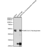 Western Blot - Anti-SARS-CoV2 Nucleoprotein Antibody (A307731) - Antibodies.com