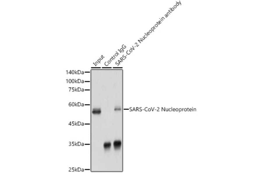 Western Blot - Anti-SARS-CoV2 Nucleoprotein Antibody (A307731) - Antibodies.com