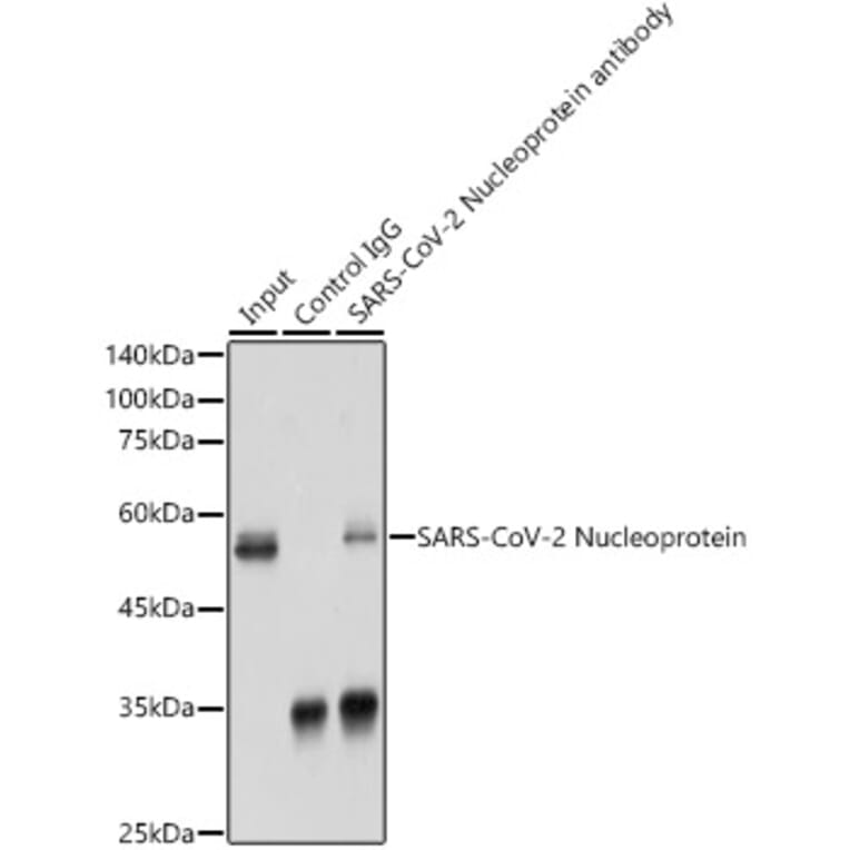 Western Blot - Anti-SARS-CoV2 Nucleoprotein Antibody (A307731) - Antibodies.com