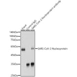 Western Blot - Anti-SARS-CoV2 Nucleoprotein Antibody (A307731) - Antibodies.com