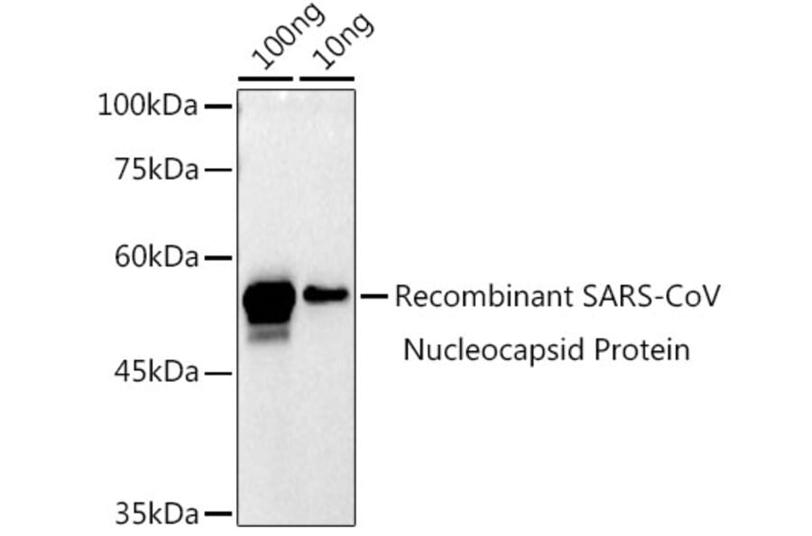 Western Blot - Anti-SARS-CoV2 Nucleoprotein Antibody (A307732) - Antibodies.com