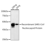 Western Blot - Anti-SARS-CoV2 Nucleoprotein Antibody (A307732) - Antibodies.com
