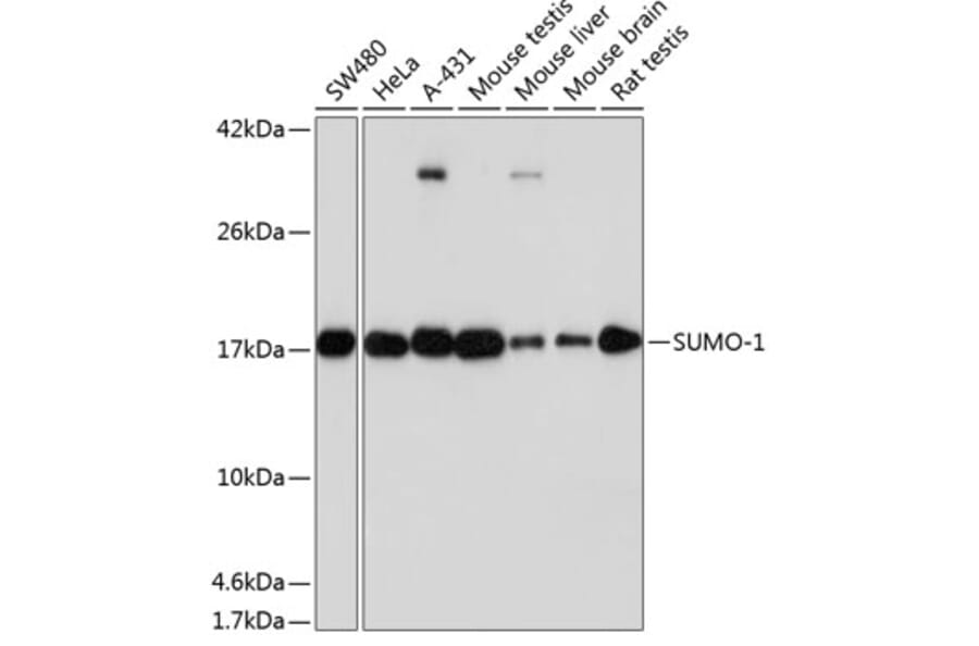 Western Blot - Anti-Sumo 1 Antibody [ARC0215] (A307733) - Antibodies.com