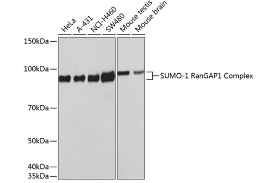 Western Blot - Anti-Sumo 1 Antibody [ARC0215] (A307733) - Antibodies.com