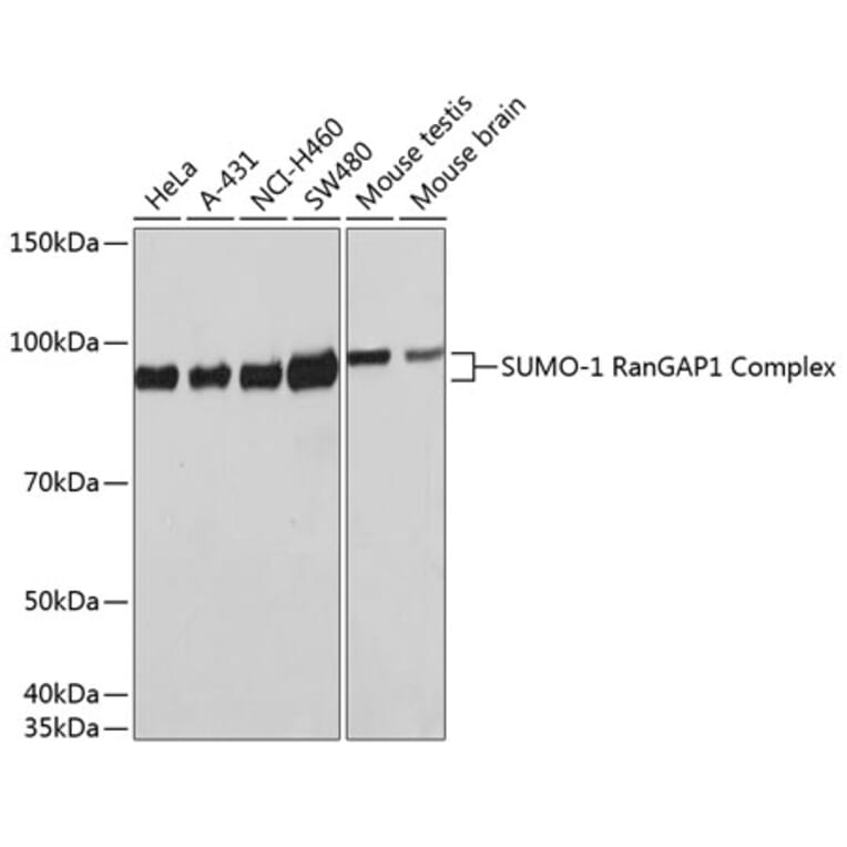 Western Blot - Anti-Sumo 1 Antibody [ARC0215] (A307733) - Antibodies.com