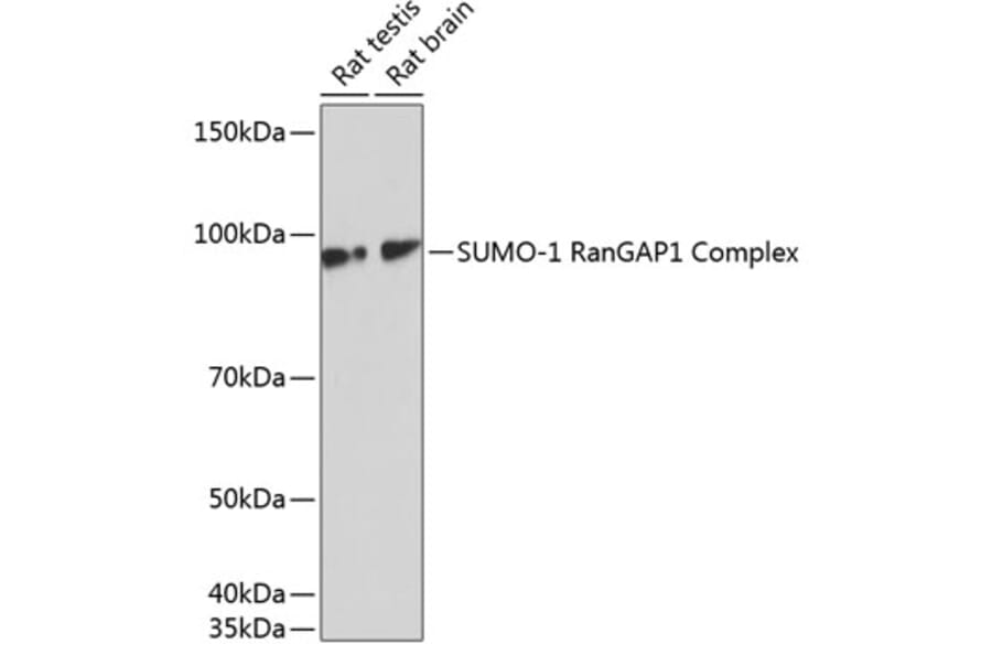 Western Blot - Anti-Sumo 1 Antibody [ARC0215] (A307733) - Antibodies.com