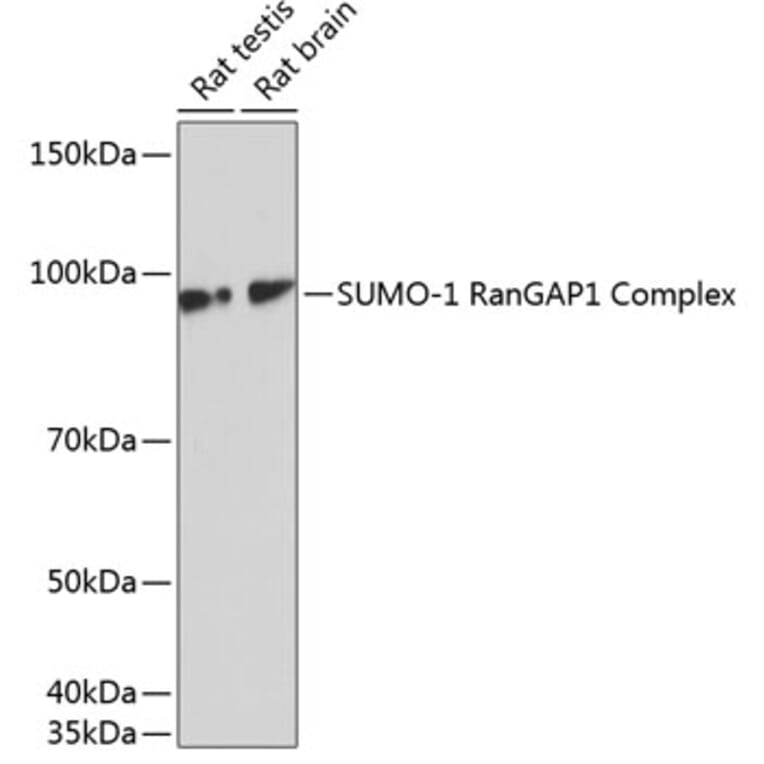 Western Blot - Anti-Sumo 1 Antibody [ARC0215] (A307733) - Antibodies.com
