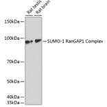 Western Blot - Anti-Sumo 1 Antibody [ARC0215] (A307733) - Antibodies.com