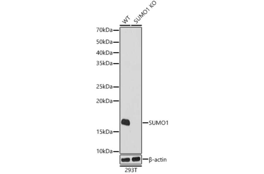 Western Blot - Anti-Sumo 1 Antibody [ARC0215] (A307733) - Antibodies.com