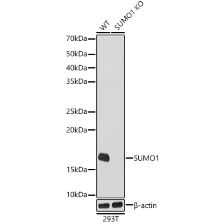Western Blot - Anti-Sumo 1 Antibody [ARC0215] (A307733) - Antibodies.com