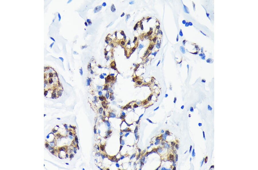 Immunohistochemistry - Anti-Sumo 1 Antibody [ARC0215] (A307733) - Antibodies.com