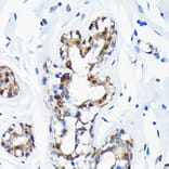 Immunohistochemistry - Anti-Sumo 1 Antibody [ARC0215] (A307733) - Antibodies.com