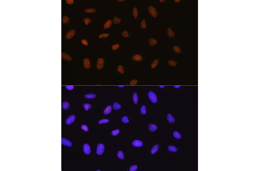 Immunofluorescence - Anti-Sumo 1 Antibody [ARC0215] (A307733) - Antibodies.com