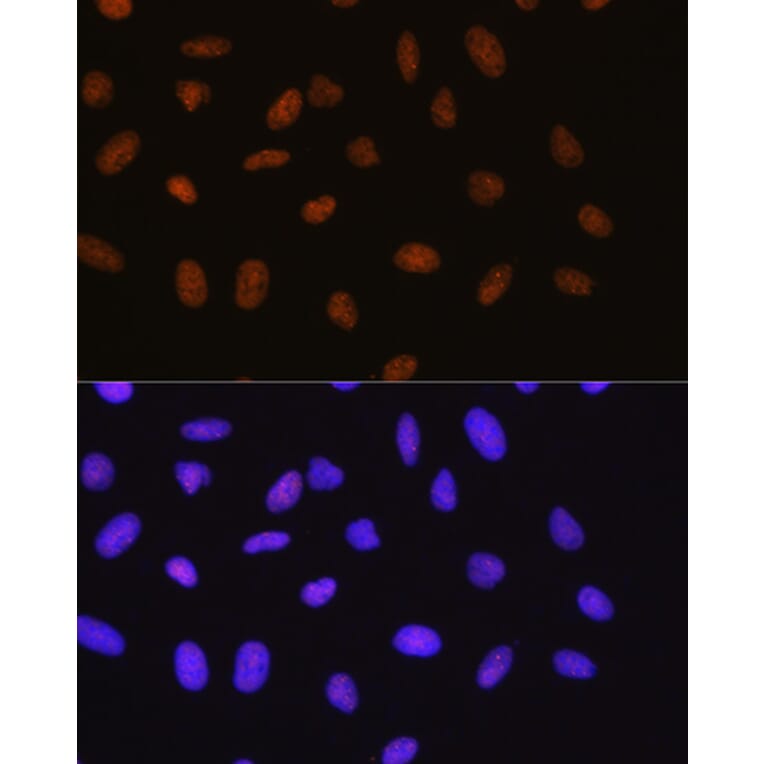 Immunofluorescence - Anti-Sumo 1 Antibody [ARC0215] (A307733) - Antibodies.com