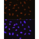 Immunofluorescence - Anti-Sumo 1 Antibody [ARC0215] (A307733) - Antibodies.com