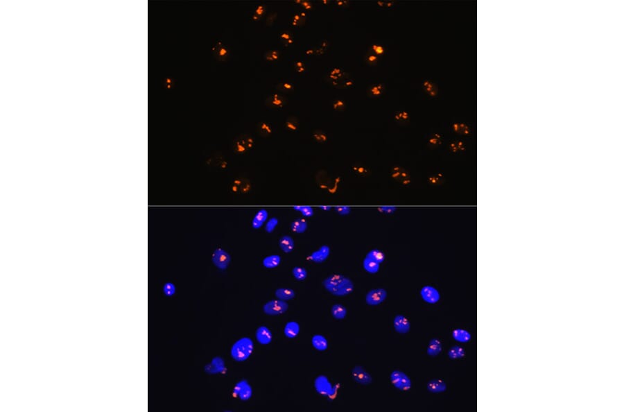 Immunofluorescence - Anti-Sumo 1 Antibody [ARC0215] (A307733) - Antibodies.com
