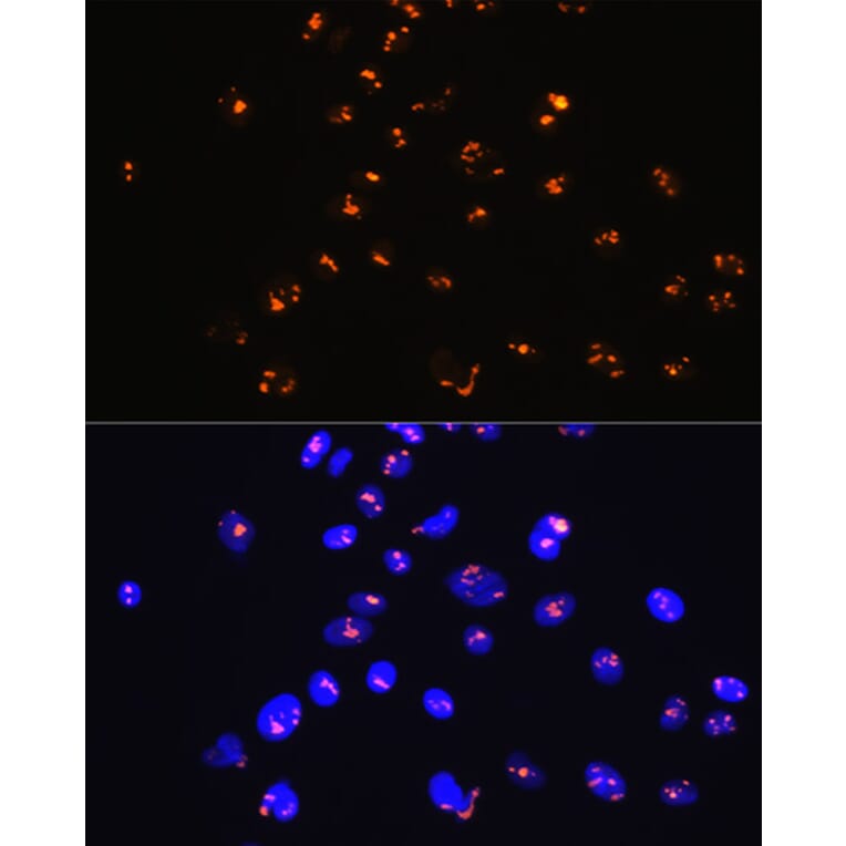 Immunofluorescence - Anti-Sumo 1 Antibody [ARC0215] (A307733) - Antibodies.com
