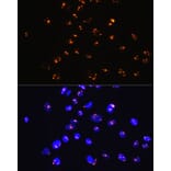 Immunofluorescence - Anti-Sumo 1 Antibody [ARC0215] (A307733) - Antibodies.com