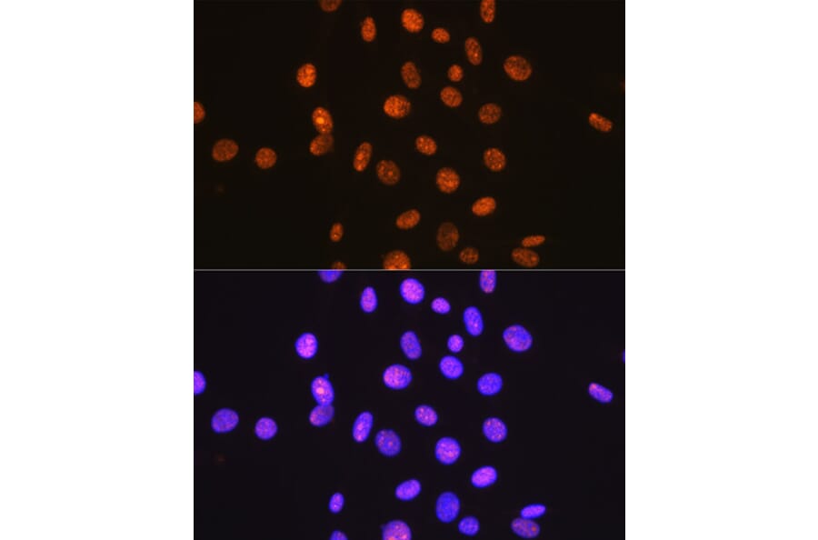 Immunofluorescence - Anti-Sumo 1 Antibody [ARC0215] (A307733) - Antibodies.com