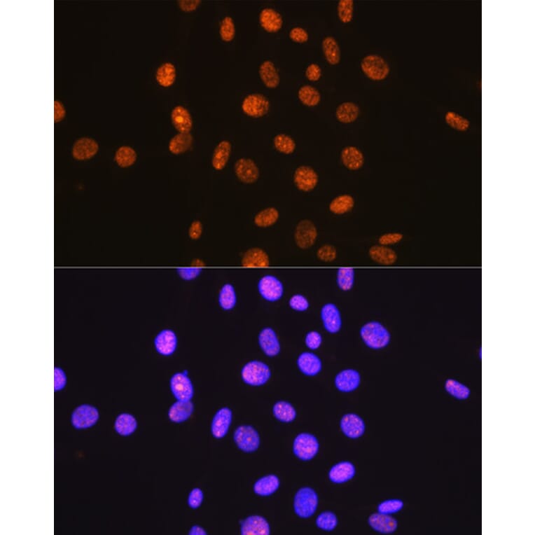 Immunofluorescence - Anti-Sumo 1 Antibody [ARC0215] (A307733) - Antibodies.com