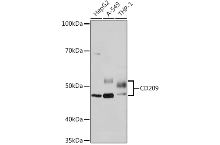 Western Blot - Anti-DC-SIGN Antibody [ARC1679] (A307735) - Antibodies.com