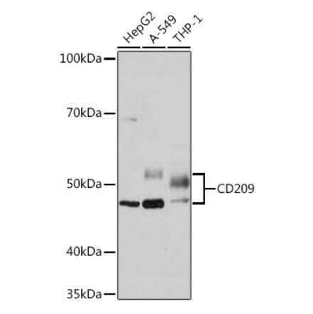Western Blot - Anti-DC-SIGN Antibody [ARC1679] (A307735) - Antibodies.com