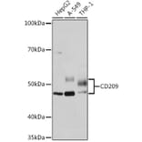 Western Blot - Anti-DC-SIGN Antibody [ARC1679] (A307735) - Antibodies.com