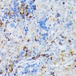 Immunohistochemistry - Anti-DC-SIGN Antibody [ARC1679] (A307735) - Antibodies.com