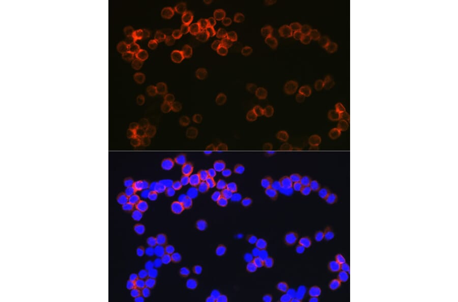 Immunofluorescence - Anti-DC-SIGN Antibody [ARC1679] (A307735) - Antibodies.com