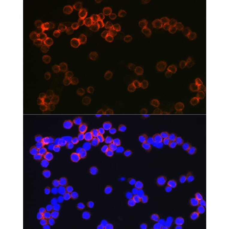 Immunofluorescence - Anti-DC-SIGN Antibody [ARC1679] (A307735) - Antibodies.com