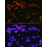 Immunofluorescence - Anti-DC-SIGN Antibody [ARC1679] (A307735) - Antibodies.com