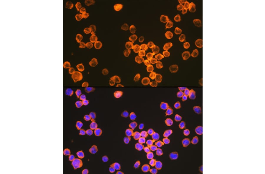 Immunofluorescence - Anti-DC-SIGN Antibody [ARC1679] (A307735) - Antibodies.com