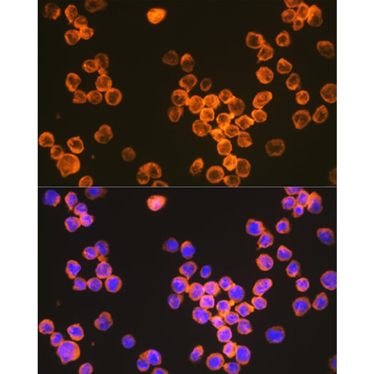 Immunofluorescence - Anti-DC-SIGN Antibody [ARC1679] (A307735) - Antibodies.com