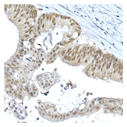 Immunohistochemistry - Anti-METTL3 Antibody (A307736) - Antibodies.com