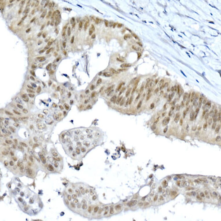 Immunohistochemistry - Anti-METTL3 Antibody (A307736) - Antibodies.com