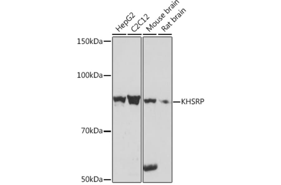 Western Blot - Anti-KHSRP Antibody [ARC1402] (A307738) - Antibodies.com