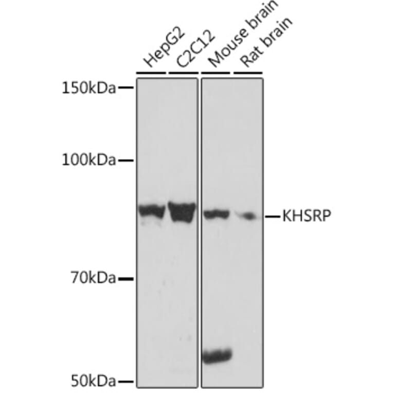 Western Blot - Anti-KHSRP Antibody [ARC1402] (A307738) - Antibodies.com
