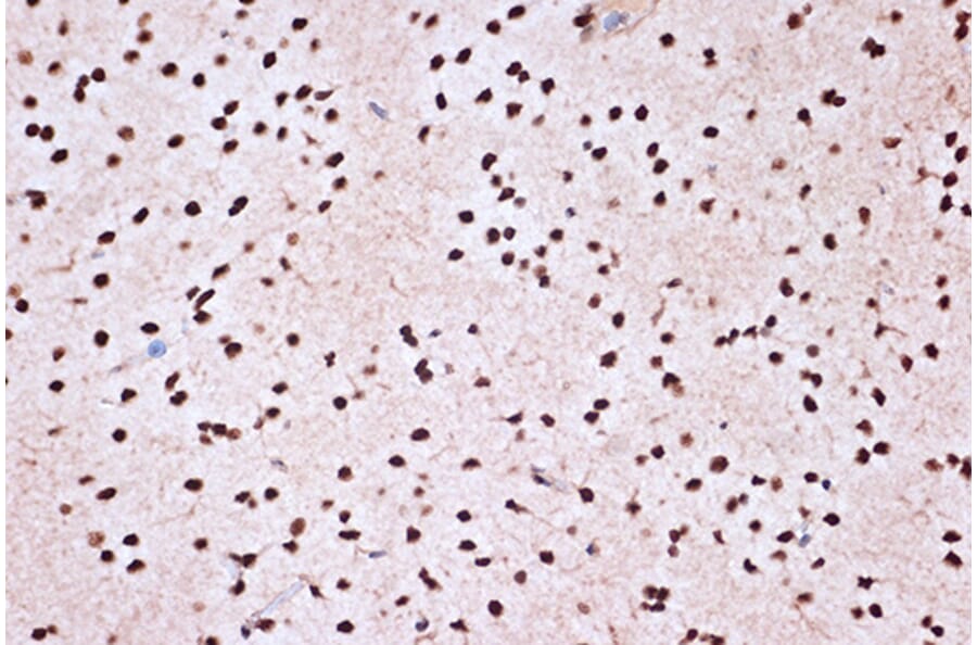 Immunohistochemistry - Anti-KHSRP Antibody [ARC1402] (A307738) - Antibodies.com