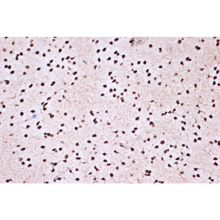 Immunohistochemistry - Anti-KHSRP Antibody [ARC1402] (A307738) - Antibodies.com