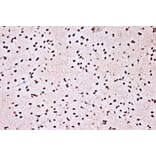Immunohistochemistry - Anti-KHSRP Antibody [ARC1402] (A307738) - Antibodies.com