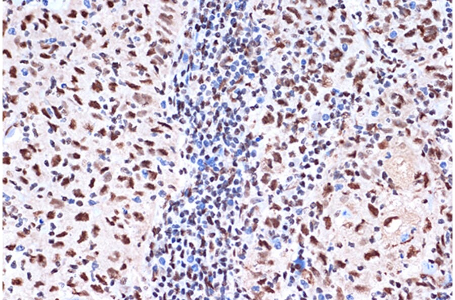 Immunohistochemistry - Anti-KHSRP Antibody [ARC1402] (A307738) - Antibodies.com