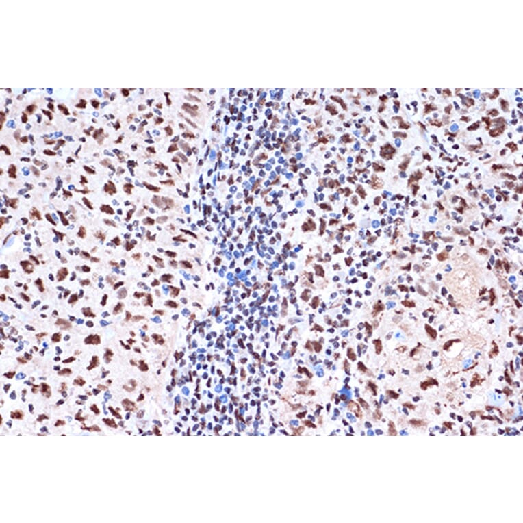 Immunohistochemistry - Anti-KHSRP Antibody [ARC1402] (A307738) - Antibodies.com