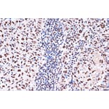 Immunohistochemistry - Anti-KHSRP Antibody [ARC1402] (A307738) - Antibodies.com