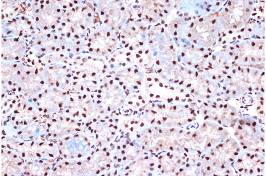 Immunohistochemistry - Anti-KHSRP Antibody [ARC1402] (A307738) - Antibodies.com