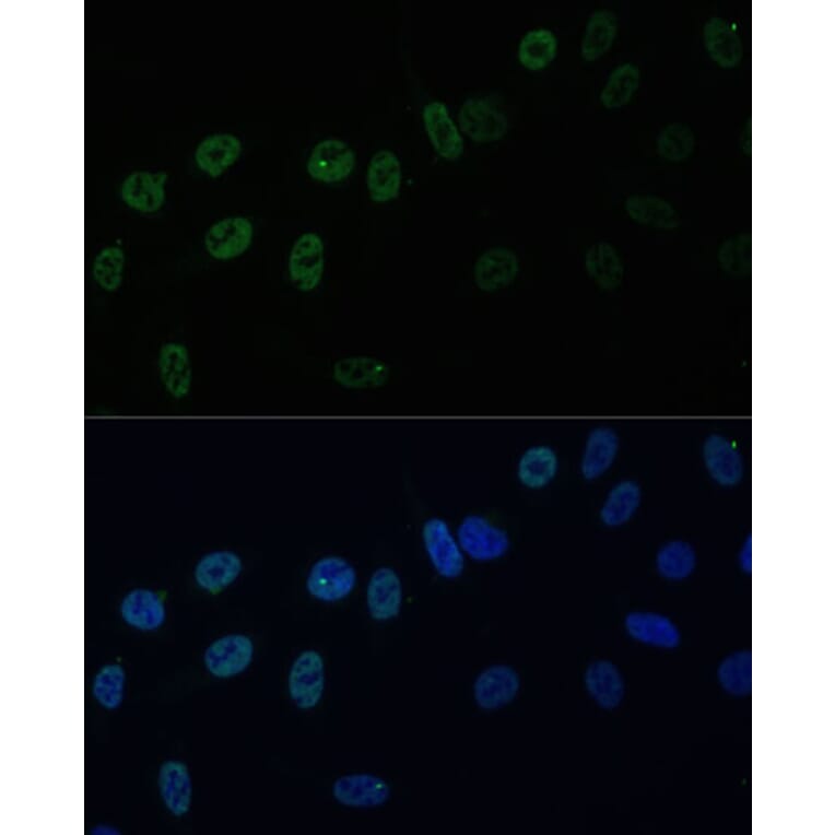 Immunofluorescence - Anti-HNRPAB Antibody (A307739) - Antibodies.com