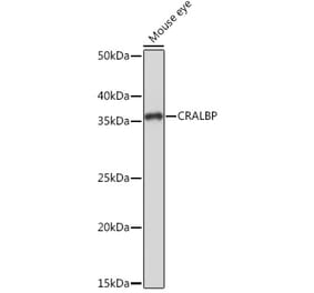 Western Blot - Anti-CRALBP Antibody [ARC1502] (A307741) - Antibodies.com
