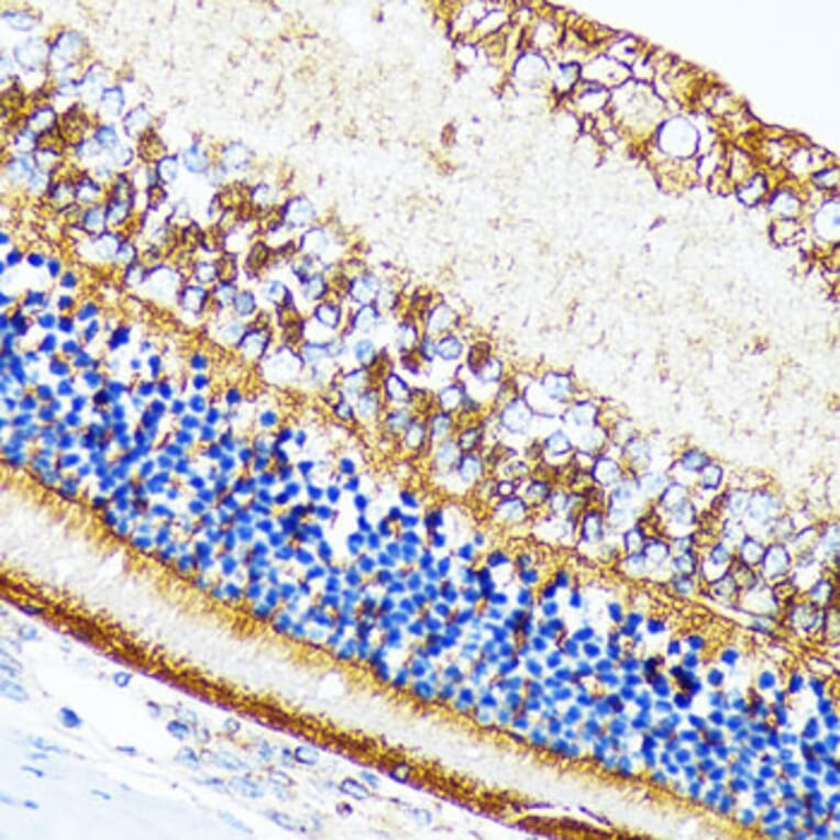 Immunohistochemistry - Anti-CRALBP Antibody [ARC1502] (A307741) - Antibodies.com