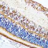 Immunohistochemistry - Anti-CRALBP Antibody [ARC1502] (A307741) - Antibodies.com